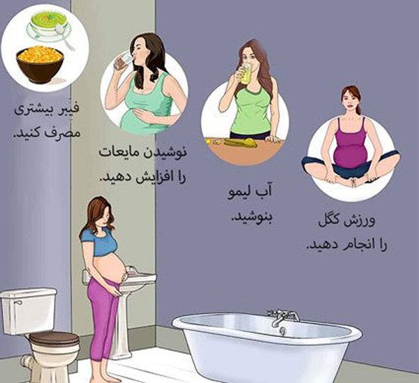  عکس بواسیر در بارداری