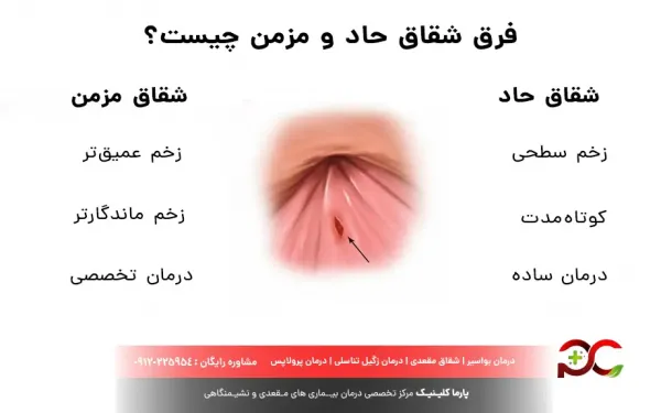  درمان خشکی مقعدی