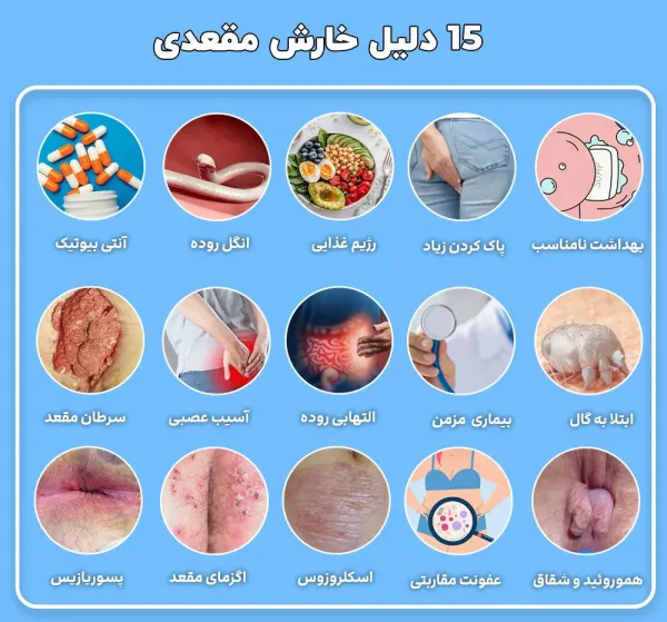  پماد برای اگزمای مقعدی