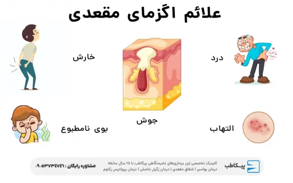  پماد برای اگزمای مقعدی