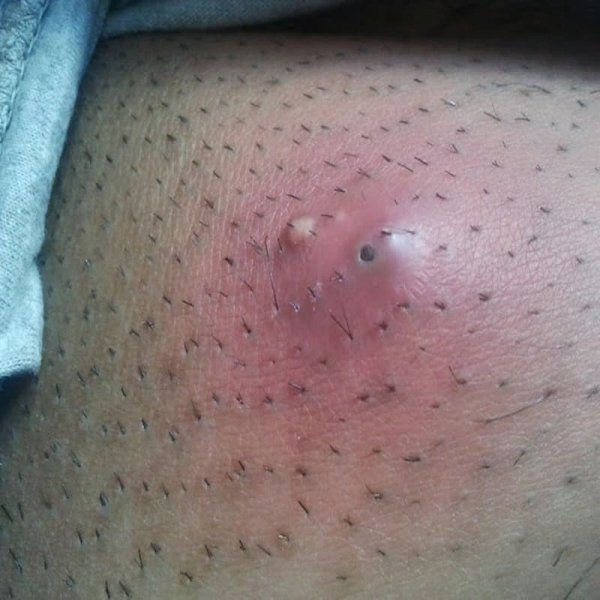  از کجا بفهمیم که کیست مویی داریم؟