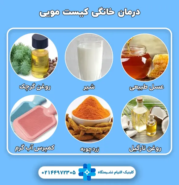  کدام روش عمل کیست مویی بهتر است؟