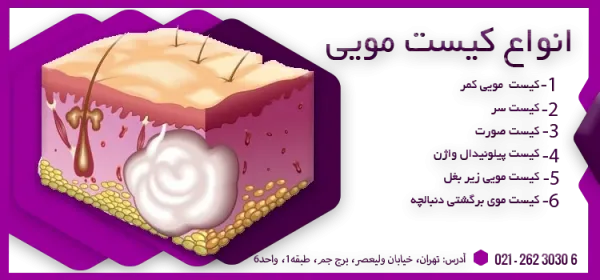  عکس سرطان کیست مویی