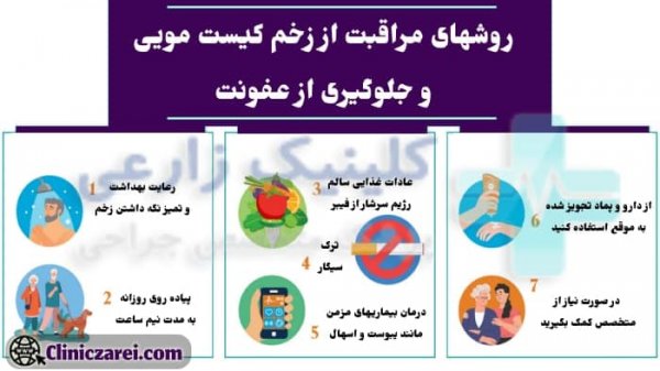  چه زمانی کیست مویی نیاز به جراحی دارد؟