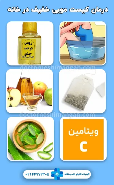  عوارض کیست مویی در زنان