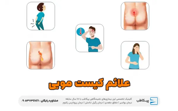  علائم ظاهری کیست مویی