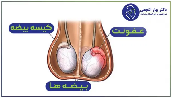 اندازه کیست بیضه