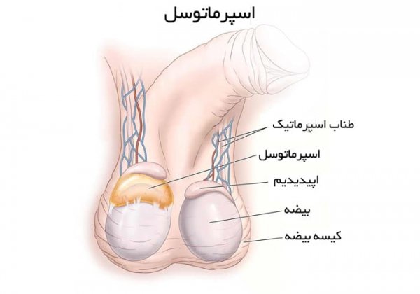  اندازه کیست بیضه