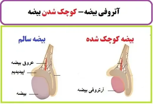  چرا یکی از بیضه ها بزرگتر است؟
