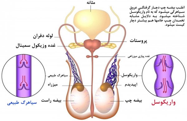  چرا یکی از بیضه ها بزرگتر است؟