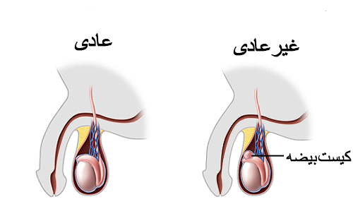  چه زمانی درد بیضه خطرناک است؟