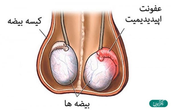  چه زمانی درد بیضه خطرناک است؟