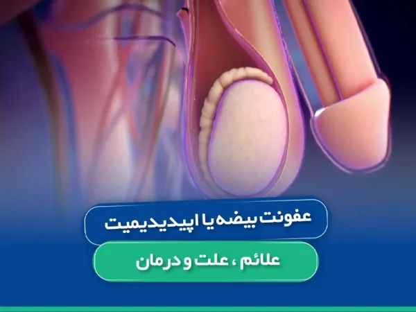 درمان عفونت بیضه چقدر طول می کشد؟