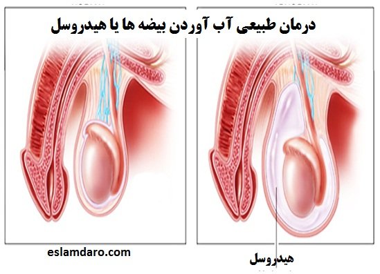  درمان گیاهی درد بیضه