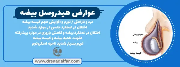  هزینه عمل هیدروسل چقدر است؟