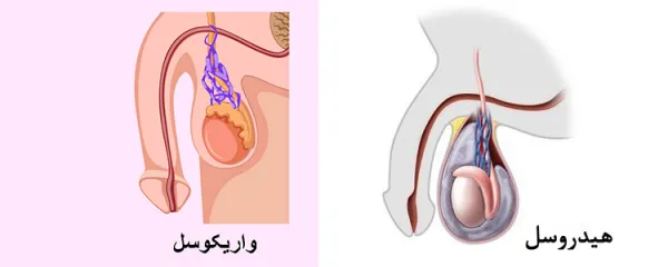  هیدروسل چگونه به وجود می آید؟