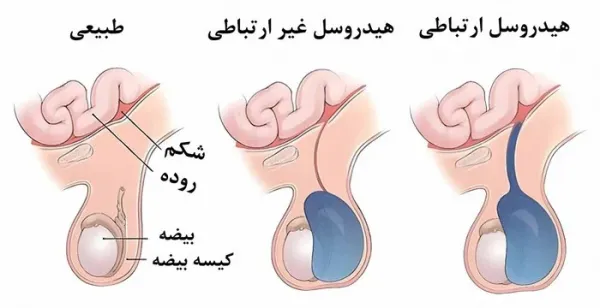  هیدروسل چگونه به وجود می آید؟