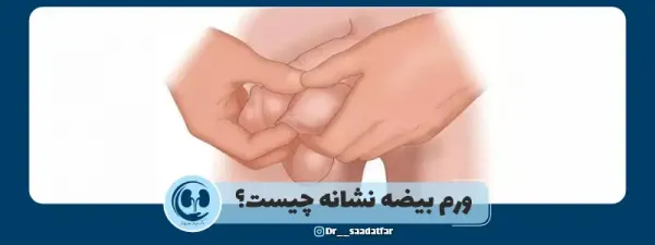 آیا ورم بیضه باعث ناباروری میشود؟