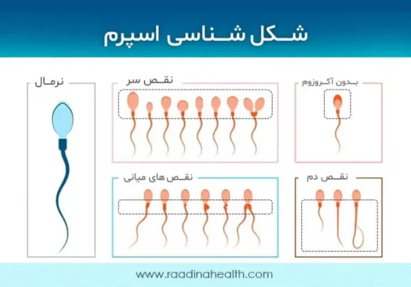  چه چیزی باعث عقیم شدن مرد میشود؟