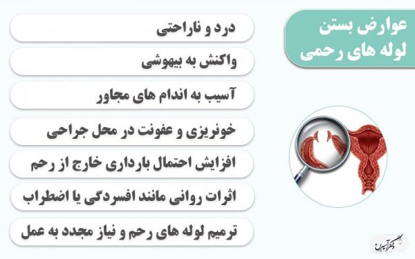  بستن لوله مردان موقت