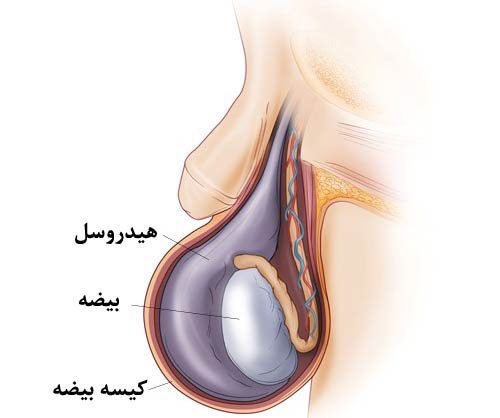  آیا هیدروسل باعث معافیت می شود؟