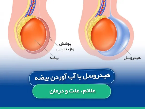 علت آب آوردن بیضه در بزرگسالان