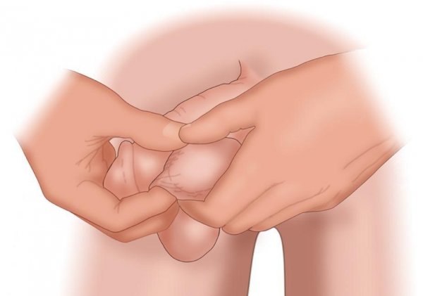 بزرگ و کوچک بودن بیضه ها نشانه چیست؟