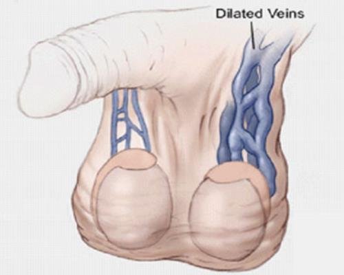  بزرگ و کوچک بودن بیضه ها نشانه چیست؟