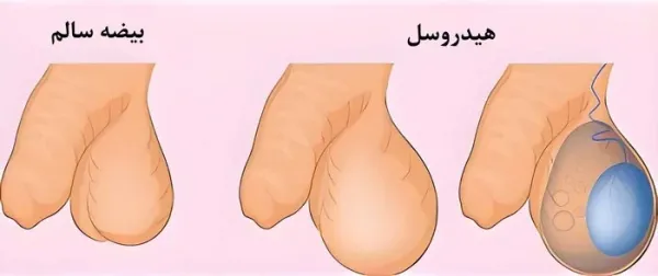  بزرگ و کوچک بودن بیضه ها نشانه چیست؟