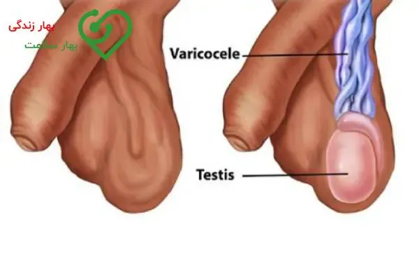  بزرگ و کوچک بودن بیضه ها نشانه چیست؟