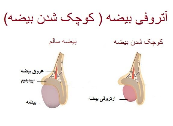  بزرگ و کوچک بودن بیضه ها نشانه چیست؟