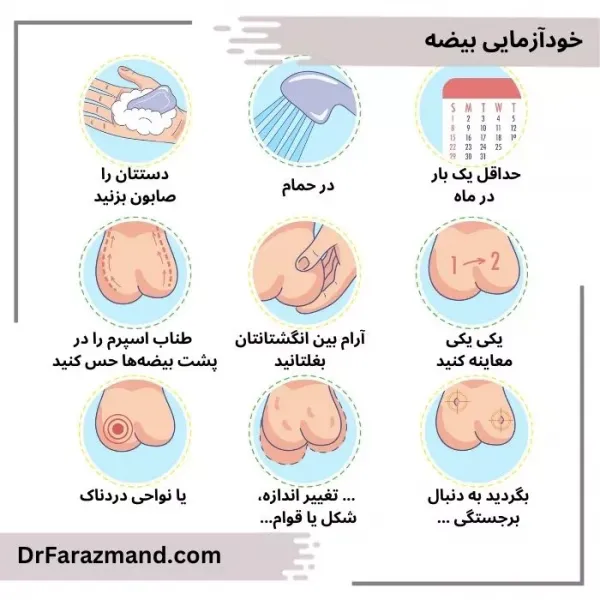  کیست بیضه بدخیم