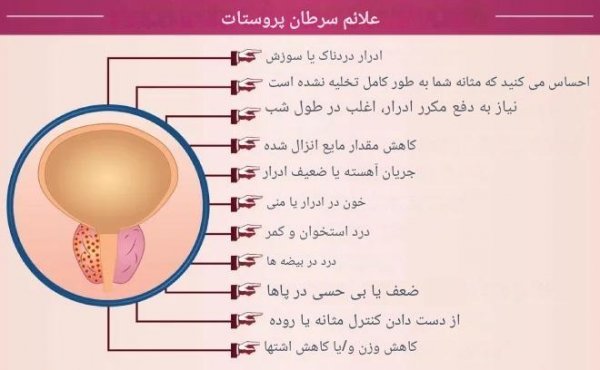  سرطان پروستات چه عوارضی دارد؟