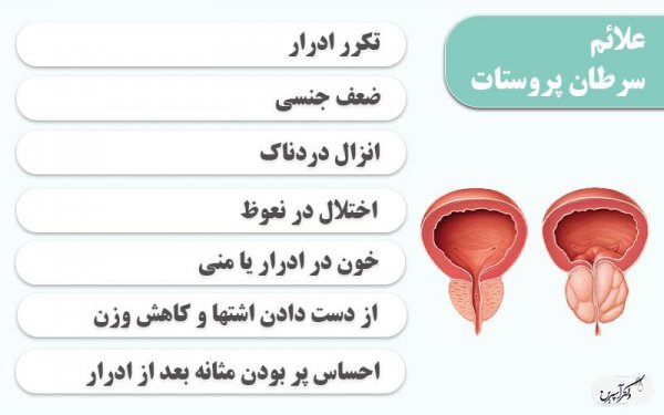  سرطان پروستات چه عوارضی دارد؟