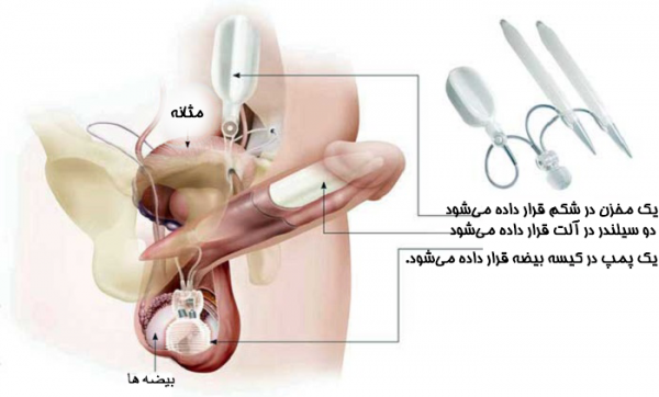  تزیین ناحیه تناسلی مردان و زنان
