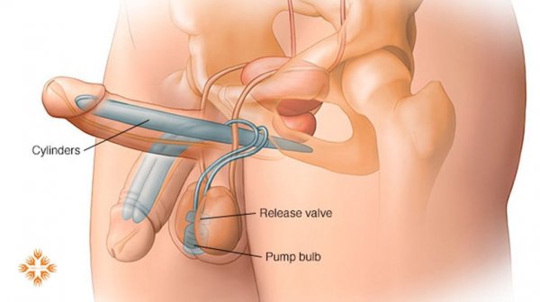  تزیین ناحیه تناسلی مردان و زنان