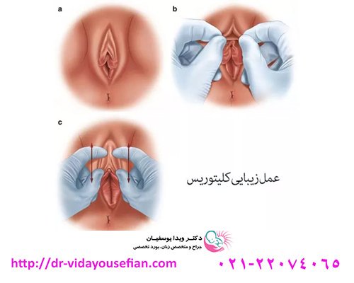  تزیین ناحیه تناسلی مردان و زنان