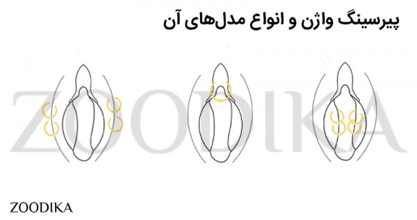  عوارض پیرسینگ واژن