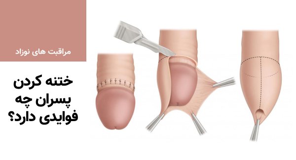  عکس زیاد بریدن پوست در ختنه