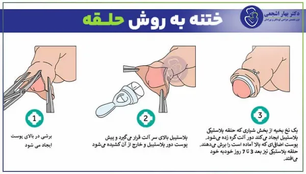 عوارض ختنه زود هنگام