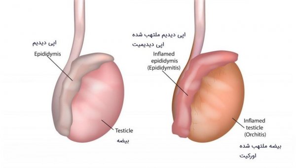  کدام بیضه برای بچه دار شدن است؟