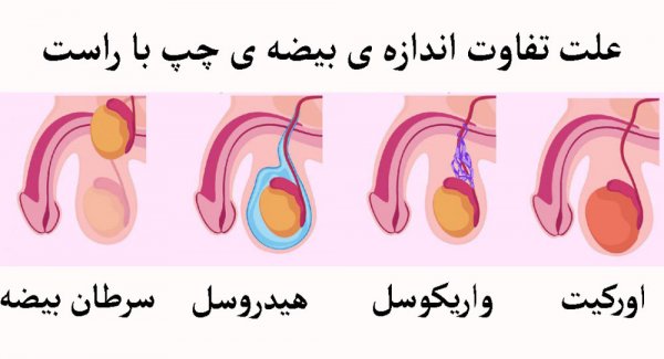  کدام بیضه برای بچه دار شدن است؟