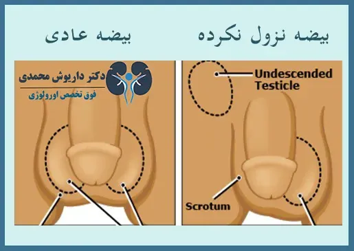  بیضه مرد کجاست + عکس بیضه واقعی