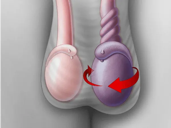  عکس پروتز بیضه + انواع پروتز بیضه