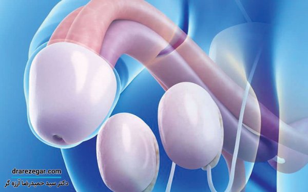  عکس پروتز بیضه + انواع پروتز بیضه