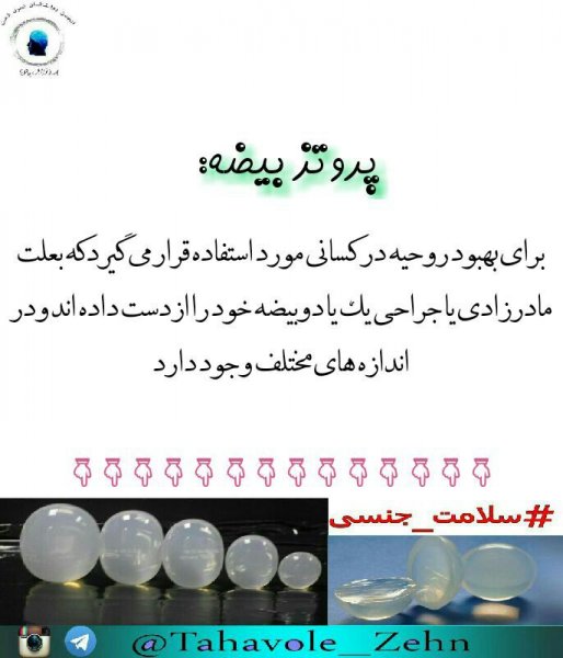  قیمت و خرید پروتز بیضه