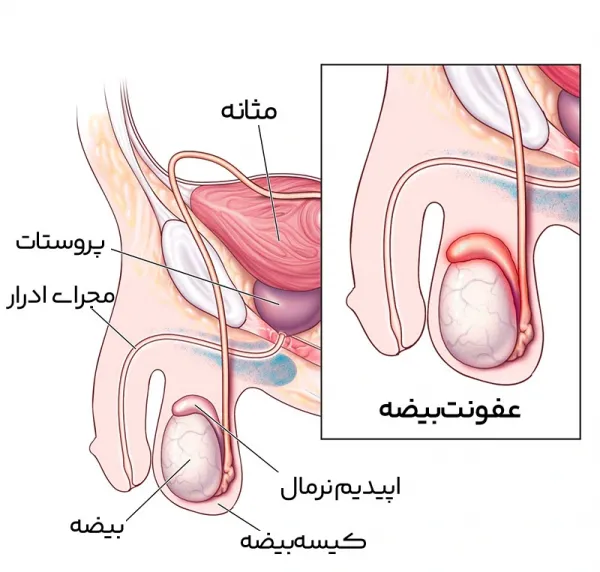  عکس کیست اپیدیدیم