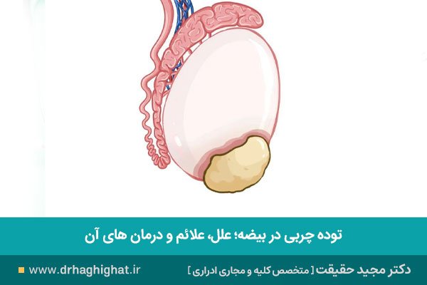  کیست خونی روی پوست بیضه