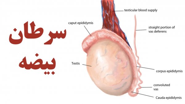 عکس سرطان بیضه