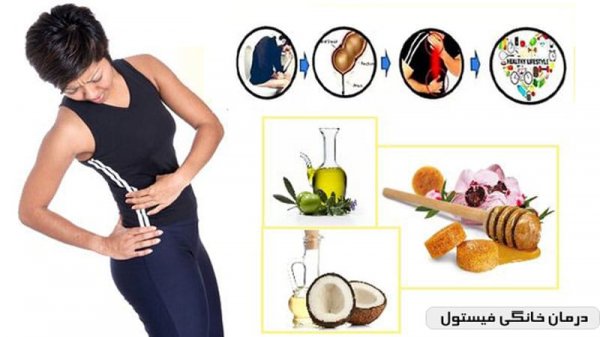  فیستول واژن در بارداری